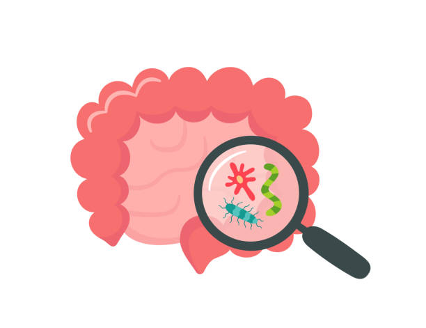 illustrazioni stock, clip art, cartoni animati e icone di tendenza di intestino umano piccolo e crasso e lente d'ingrandimento. microbioma intestinale. sibo, sindrome intestinale che perde e crescita della candida. intestino astratto. illustrazione vettoriale isolata su sfondo bianco - alimentary