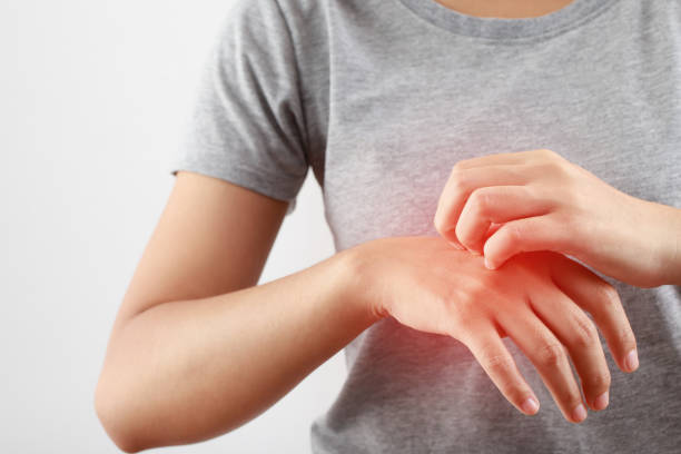 istock Woman is having itchy skin 1325263590
