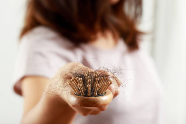 istock health problems, women hair loss 1325263637