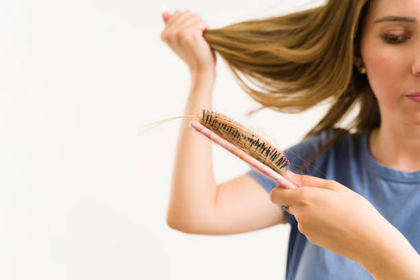 istock Troubled woman suffering from alopecia 1325282335