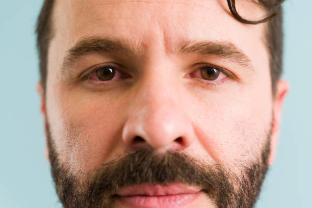 istock Depressed man with an eye infection 1325287369