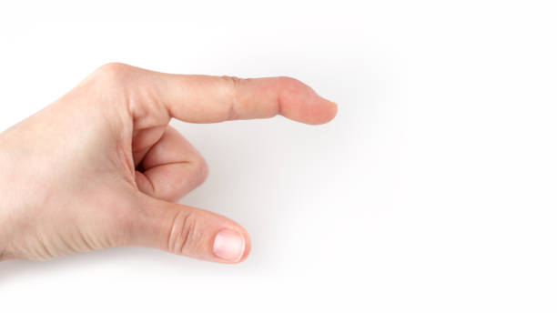 una palma izquierda con un dedo índice de flexión de dolor hacia abajo - deformed fotografías e imágenes de stock