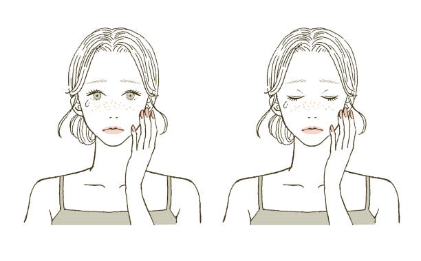 Beauty Illustration of a woman suffering from acne Beauty Illustration of a woman suffering from acne freckle stock illustrations