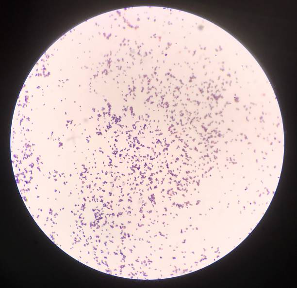 istock Bacteria cells in gram stain. 1325382707
