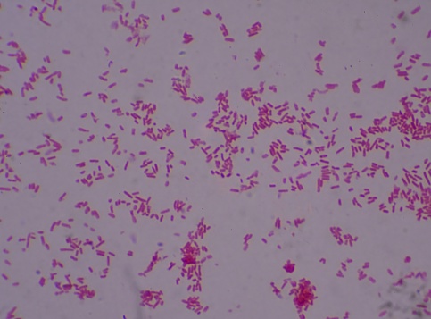 Gram negative bacilli wiih bipola stain finding with microscope.