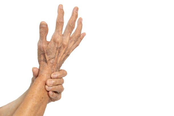 close up hands of old elderly have cold hands,blood circulation problems in diabetic patient,painful or numbness of the hand and fingers,trigger finger disease isolated on white background,health care - finger on the trigger imagens e fotografias de stock
