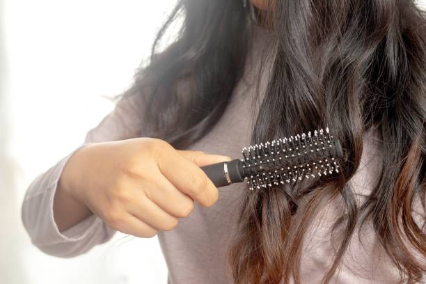 istock Women are allergic to shampoo causing hair loss and dandruff. 1325677955