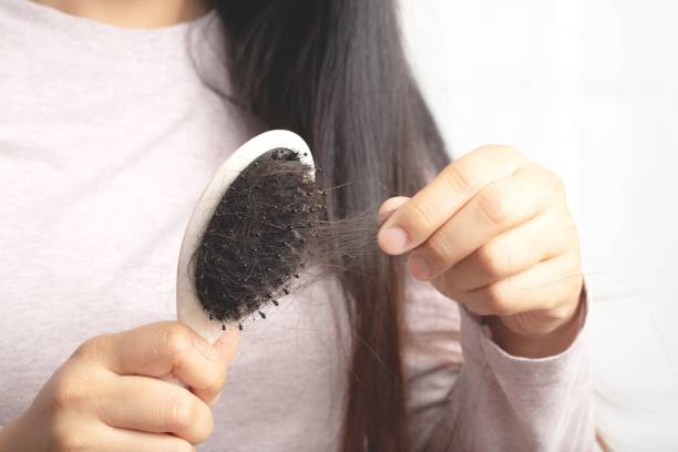 istock Women are allergic to shampoo causing hair loss and dandruff. 1325677970