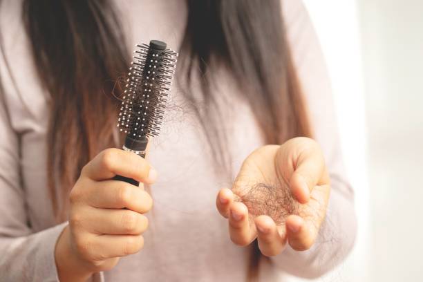 istock Women are allergic to shampoo causing hair loss and dandruff. 1325678020