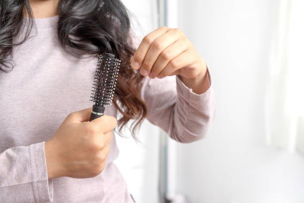 istock Women are allergic to shampoo causing hair loss and dandruff. 1325678132