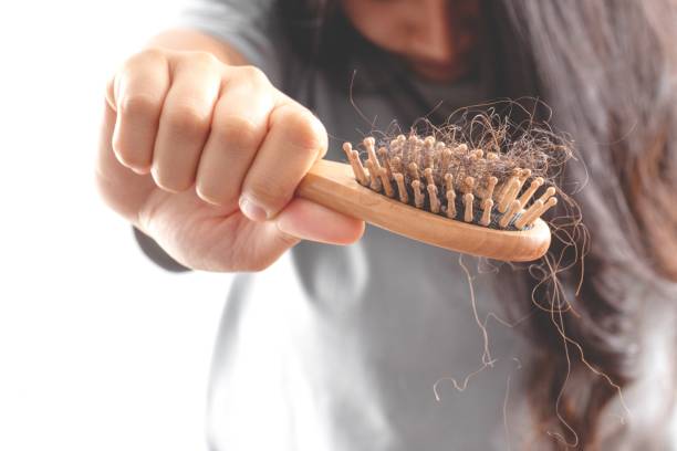 istock Women are allergic to shampoo causing hair loss and dandruff. 1325678877