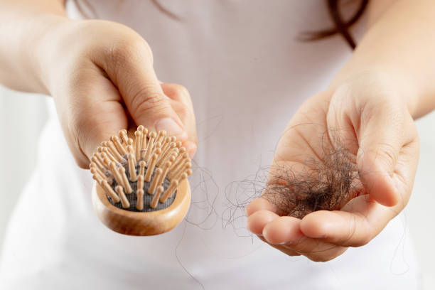 istock Women allergic to shampoo causing hair loss, baldness, dandruff 1325727877