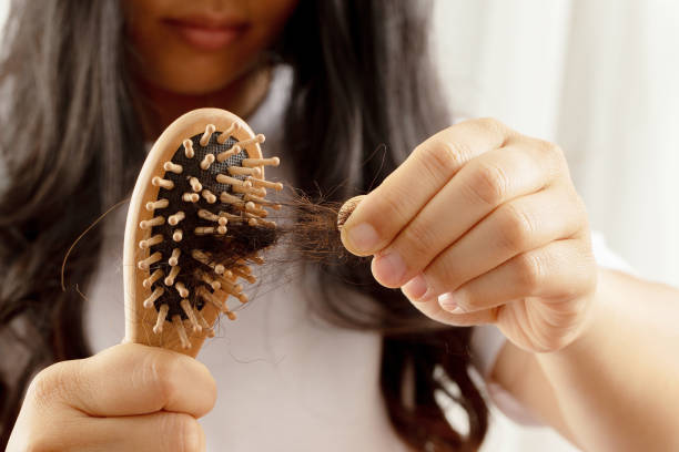 istock Women allergic to shampoo causing hair loss, baldness, dandruff 1325727931