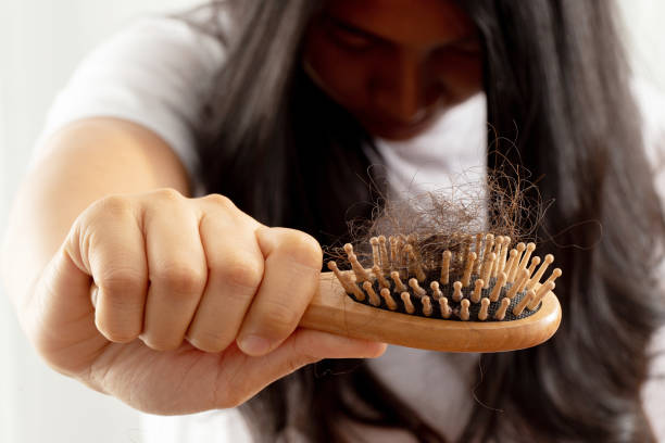 istock Women allergic to shampoo causing hair loss, baldness, dandruff 1325727940