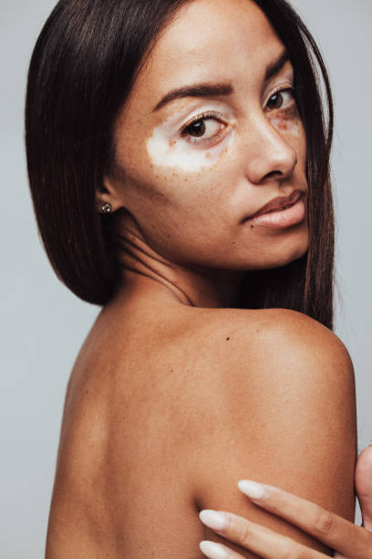 istock Confident in your own skin 1325742375