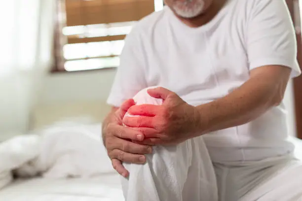 Asian Elderly senior man with white hairs have a knee pain and illness injury on Knee bursitis and gout on bed at home,unhappy elderly touch on knee serious and tried,Elder Care Concept