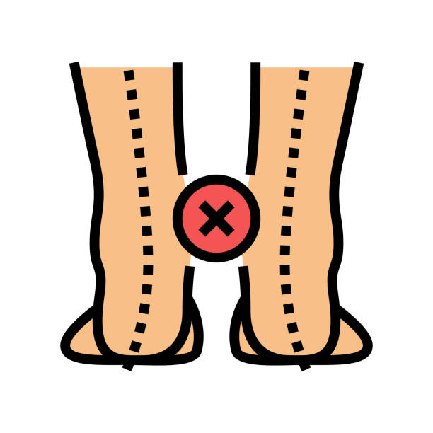 istock curvature of legs inward color icon vector illustration 1325876289
