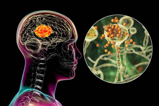 mukormycosis mózgu, uszkodzenie mózgu spowodowane przez grzyby mucor, znany również jako czarny grzyb, z bliska widzenia grzybów, ilustracja 3d - known how zdjęcia i obrazy z banku zdjęć