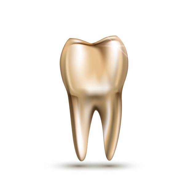 Golden tooth Golden tooth with root on white background dental gold crown stock illustrations