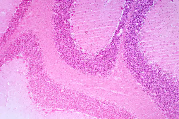 Photo of Cerebellum cross section tissue under the light microscope for pathology education.