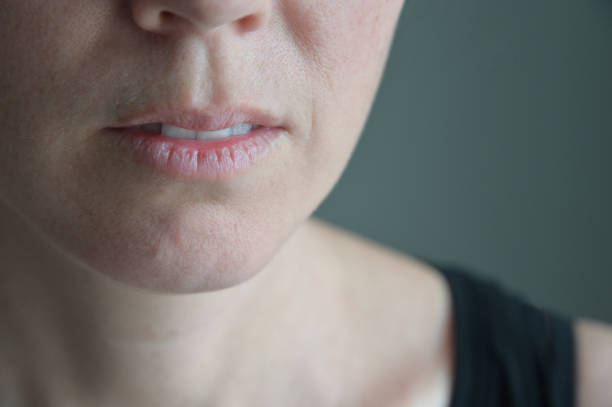 la mujer sufre de unos labios muy secos - seco fotografías e imágenes de stock