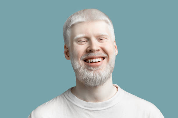 ritratto di uomo albino barbuto felice con pelle pallida e capelli bianchi sorridenti alla fotocamera su sfondo turchese - insolito foto e immagini stock