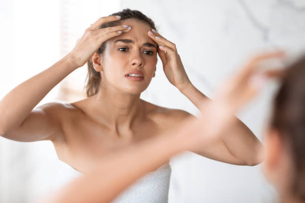 istock Frustrated Lady Squeezing Pimple On Forehead In Modern Bathroom Indoors 1326451045