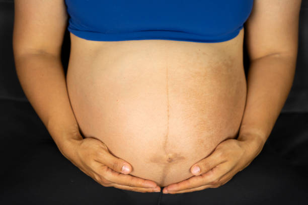 Unrecognizable pregnant woman with her hsnds on her exposed belly.