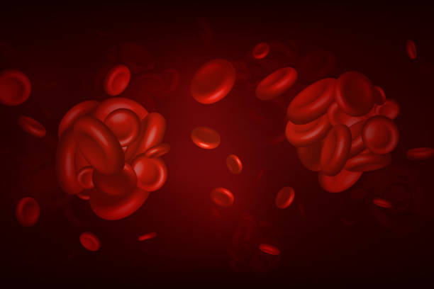 ilustrações de stock, clip art, desenhos animados e ícones de blood clots, thrombus or embolus with coagulated erythrocytes. - coágulo