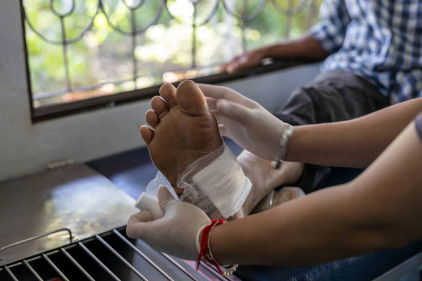 A nurse applies a bandage to an elderly foot. A close-up view of a female nurse wrapping a cloth over an elderly foot wound inside a health center in rural Thailand. wounded stock pictures, royalty-free photos & images