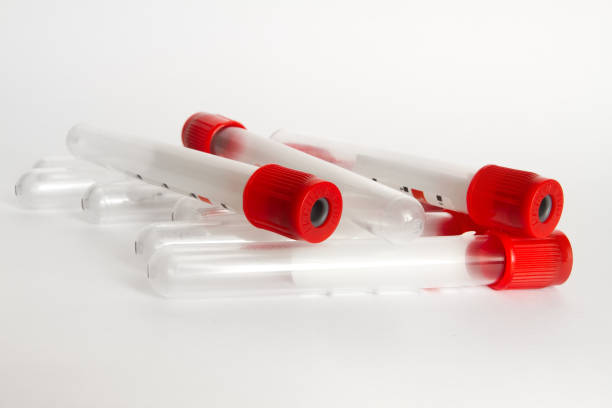 istock there are several red blood test tubes on the table 1326944227