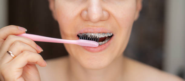 istock Girl with braces on her teeth brushing her teeth with a toothbrush 1327031361