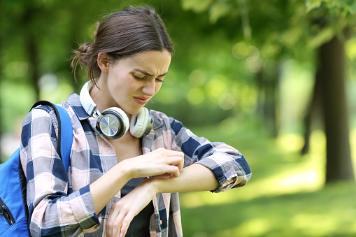 Allergic student scratching itchy arm in a park or campus