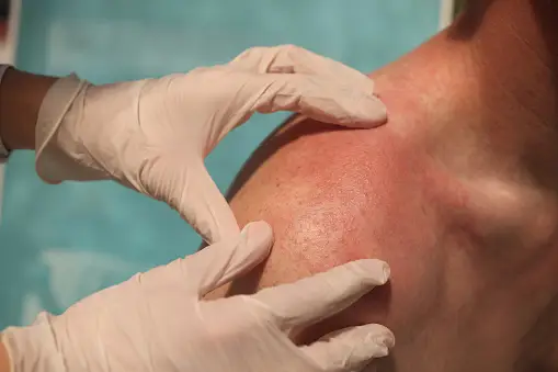 Recognizing and Treating Skin Rashes: Revealing Remedies Recognizing and Treating Skin Rashes: Revealing Remedies