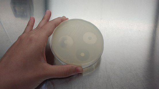 Cropped shot of hand hold checking laboratory plate, clear zone of antibiotic disc.