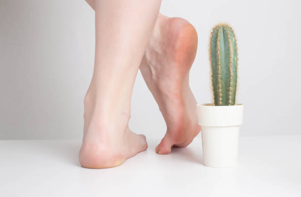 cactus cerca de las piernas de la niña sobre un fondo blanco. concepto de dolores de costura e incomodidad en piernas y pies humanos. enfermedades en el talón, osteomielitis - cactus spine fotografías e imágenes de stock