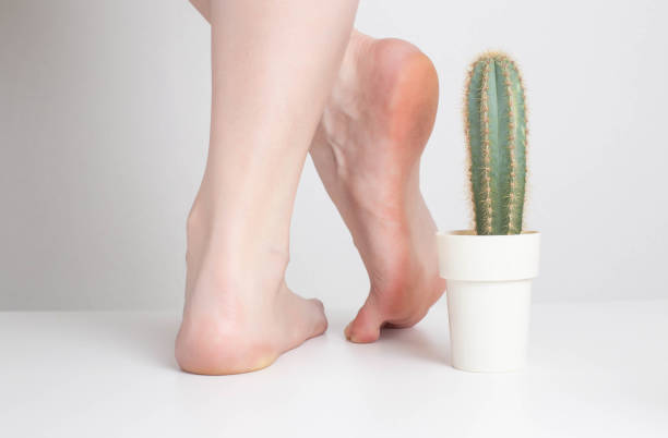 白い背景に女の子の足の近くにサボテン。人間の足と足のステッチの痛みや不快感の概念。かかとの病気、骨髄炎 - cactus spine ストックフォトと画像