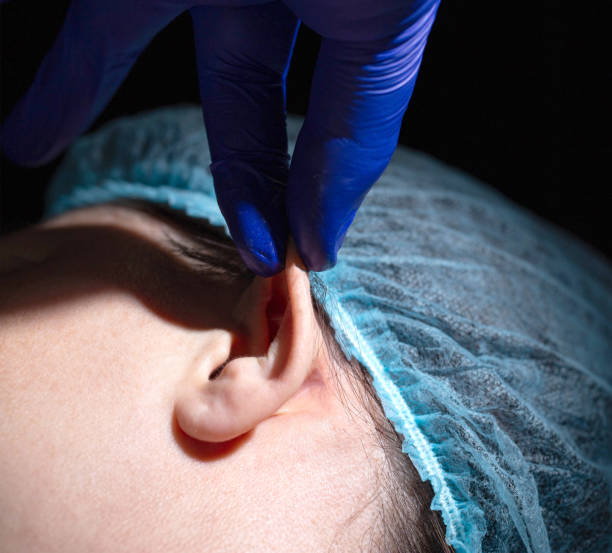 A plastic surgeon performs an operation to correct the ears of a female patient. Otoplasty, elimination of protruding ears, plastic surgery. Close-up A plastic surgeon performs an operation to correct the ears of a female patient. Otoplasty, elimination of protruding ears, plastic surgery Earlobe stock pictures, royalty-free photos & images