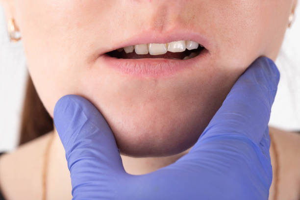 The doctor checks the jaw of a girl who has a malocclusion of her mouth and teeth, close-up, orthodontist The doctor checks the jaw of a girl who has a malocclusion of her mouth and teeth, close-up malocclusion stock pictures, royalty-free photos & images