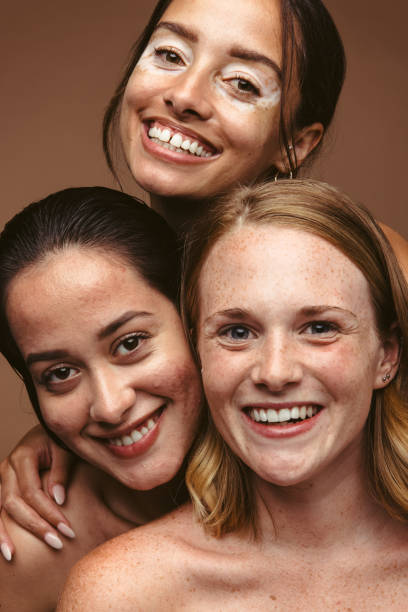 istock Happiness is about looking beyond imperfections 1327262552