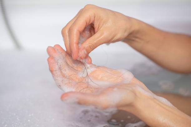 istock Hair falling out in  hands after rinse off shampoo. 1327527456