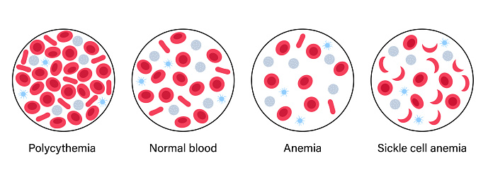 혈액 구조 개념 빈혈에 대한 스톡 벡터 아트 및 기타 이미지 - 빈혈, 세포, Platelet-rich Plasma - iStock