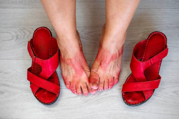 цветная кожаная обувь делала цветные пятна на ногах - slipper senior adult shoe human leg стоковые фото и изображения