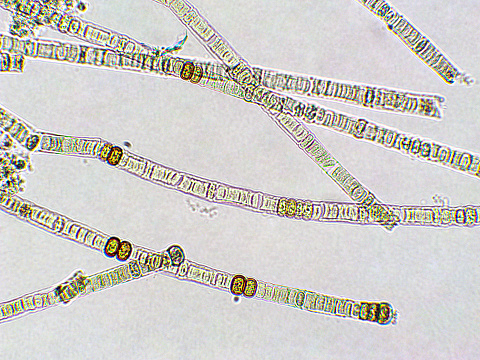 Nodularia sp. toxic algae under microscopic view, nitrogen-fixing cyanobacteria, cyanotoxin, harmful to humans, x40