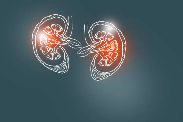 Kidney Failure Illustrations, Royalty-Free Vector Graphics & Clip Art -  iStock