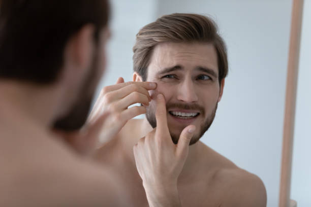 istock Frustrated handsome millennial guy concerned about facial skin problem 1327874232
