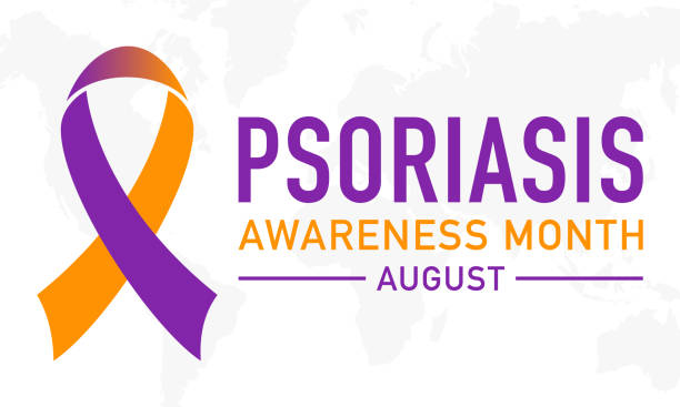illustrations, cliparts, dessins animés et icônes de bannière vectorielle du mois de sensibilisation au psoriasis, affiche, carte, modèle de sensibilisation aux antécédents observé en août de chaque année. - psoriasis