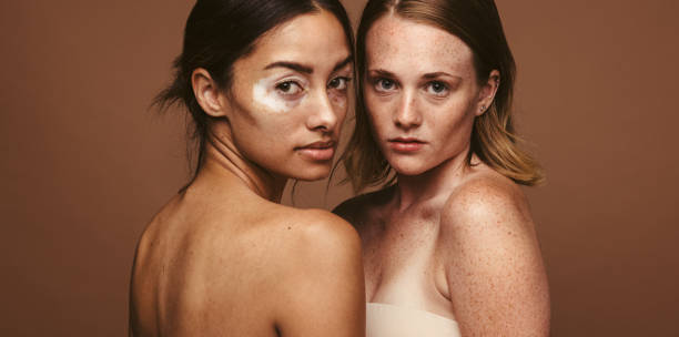 istock Confident woman with unique skin 1328120308