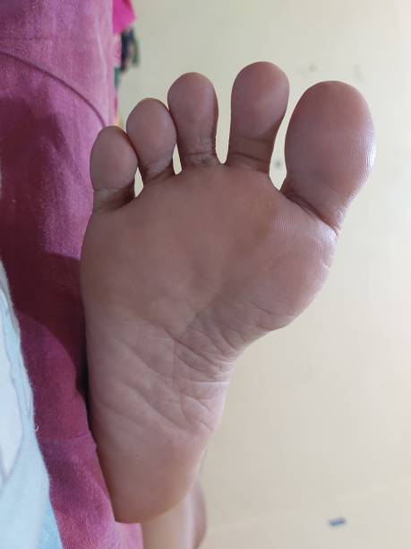 istock soles of the feet 1328168109