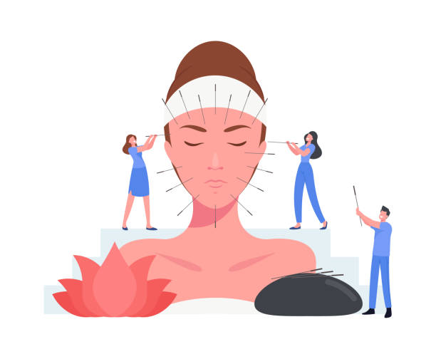 illustrazioni stock, clip art, cartoni animati e icone di tendenza di concetto di terapia cinese dell'agopuntura. i piccoli personaggi iniettano aghi in un enorme viso femminile. modulo di medicina alternativa - alternative therapy massaging clinic health spa